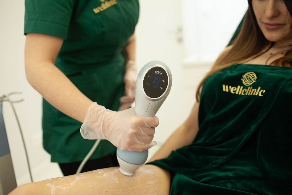 cellulite in slim people