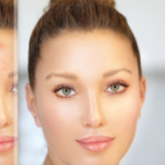 Лазерное удаление сосудов