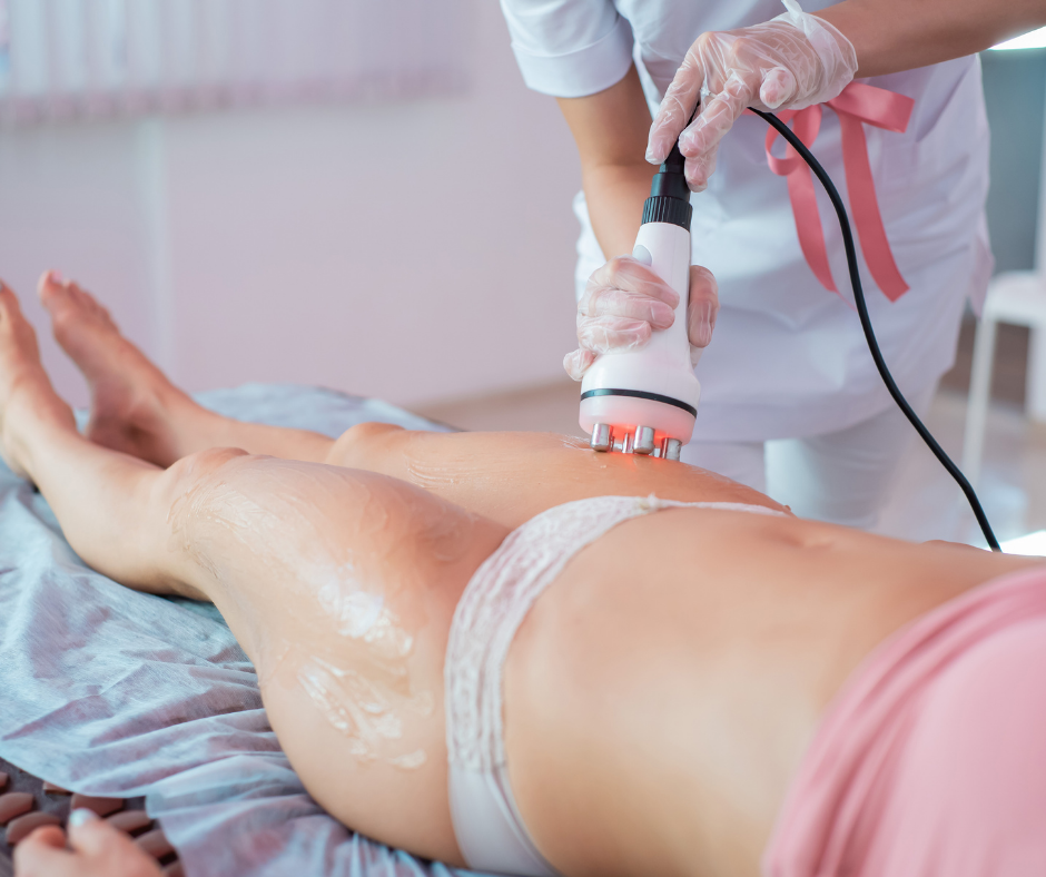 Dauerhafte Beseitigung von Cellulite