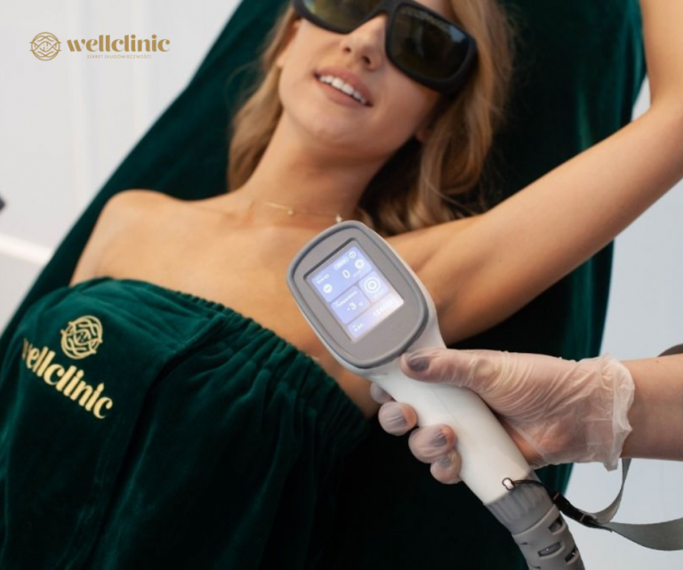 Laser hair removal treatment