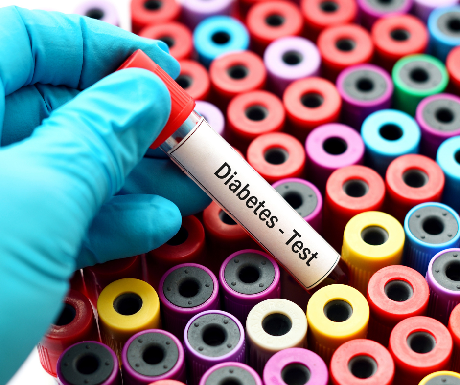 Testing for diabetes