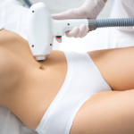 Laser abdominal hair removal