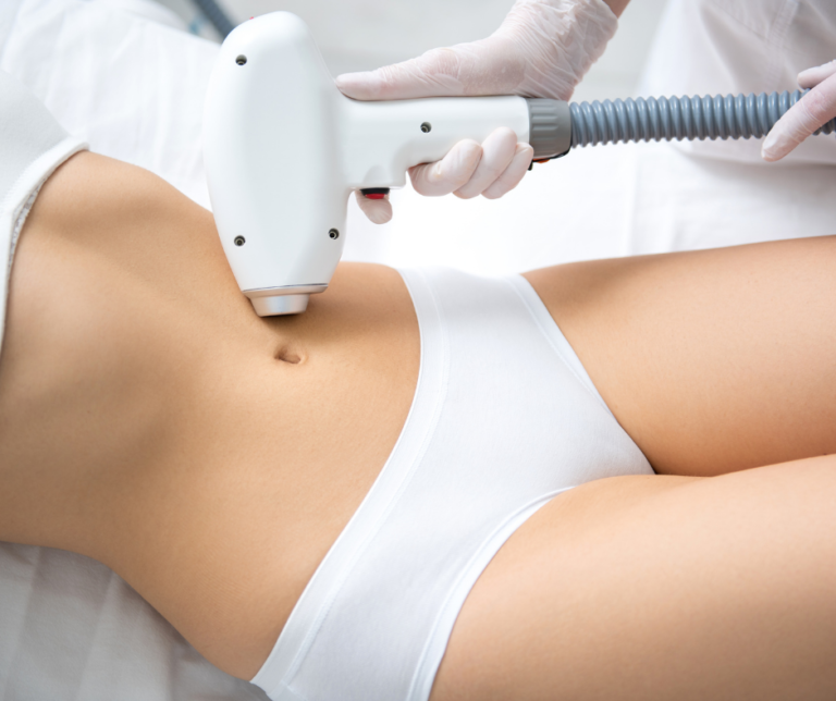 Laser abdominal hair removal