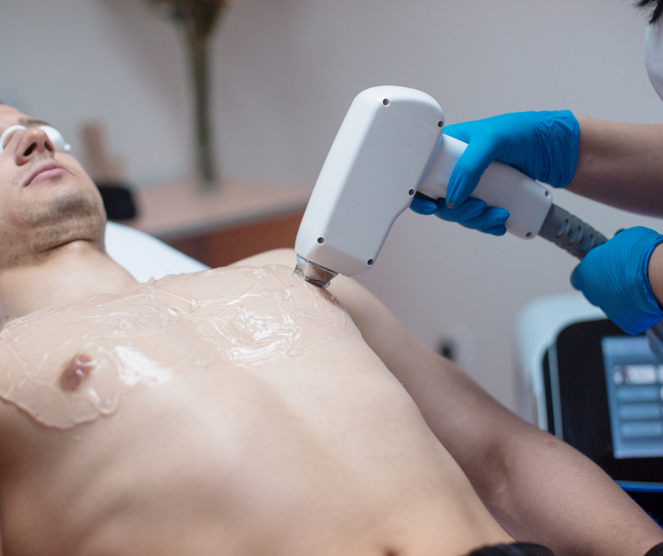 Depilacja laserowa klatki piersiowej