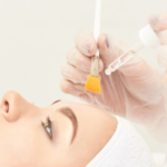 Peeling chemiczny TCA REGEN PEEL w Wellclinic