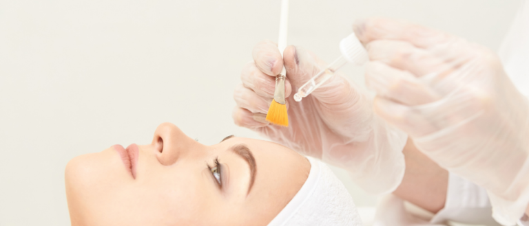 Chemical peeling TCA REGEN PEEL at Wellclinic