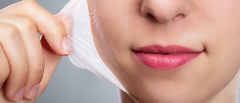 chemical peelings at wellclinic
