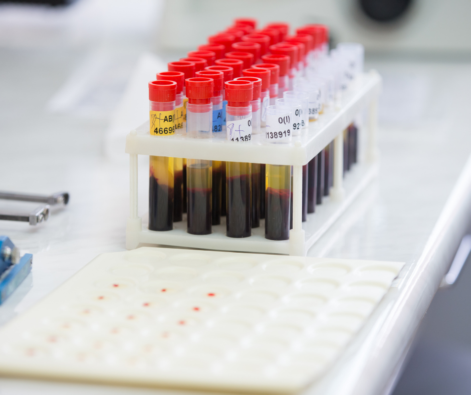 Specialist blood tests