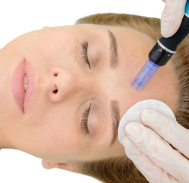 Biostymulator tkankowy