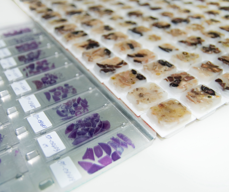 Histopathological examination