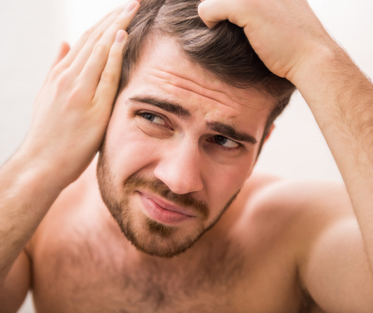how to hide hair loss
