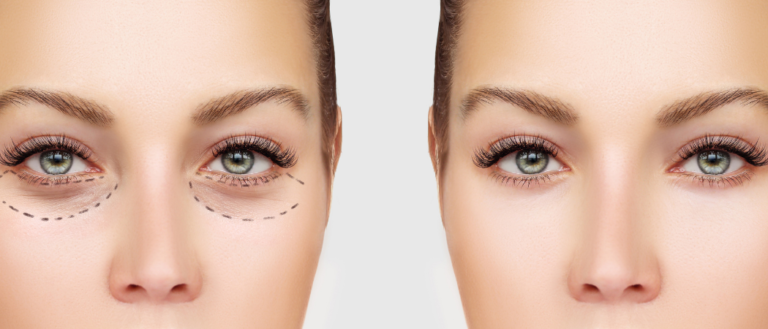 Заполнение долины слез в Wellclinic