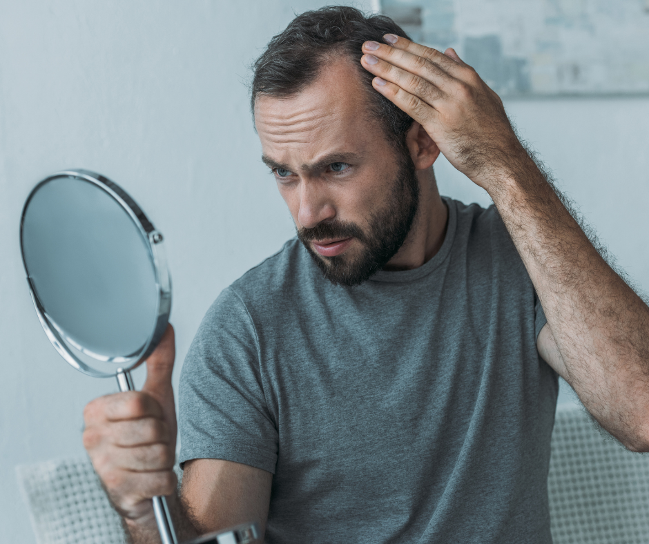 alopecia areata