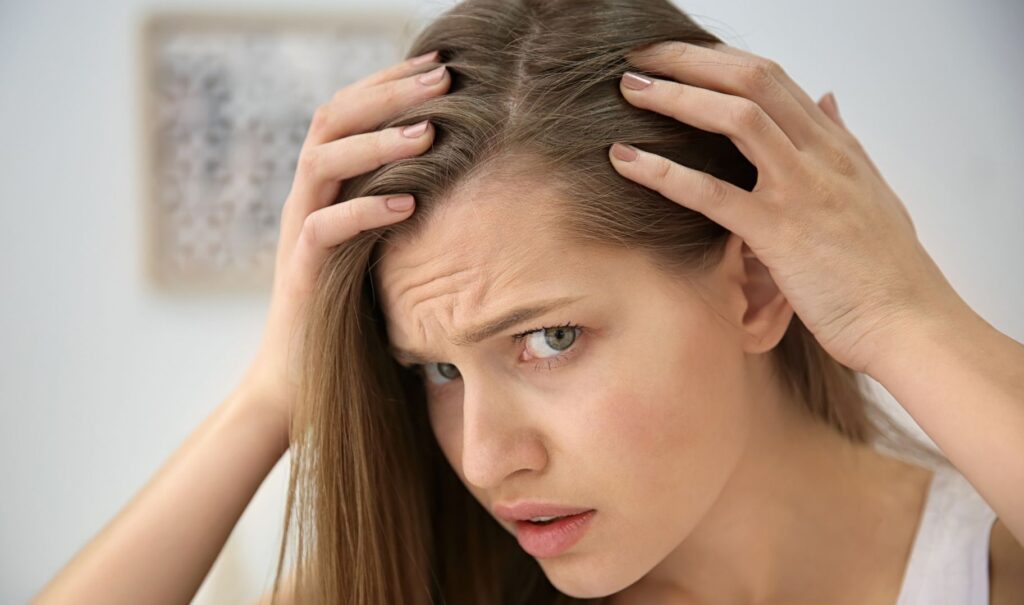 androgenetic alopecia in women