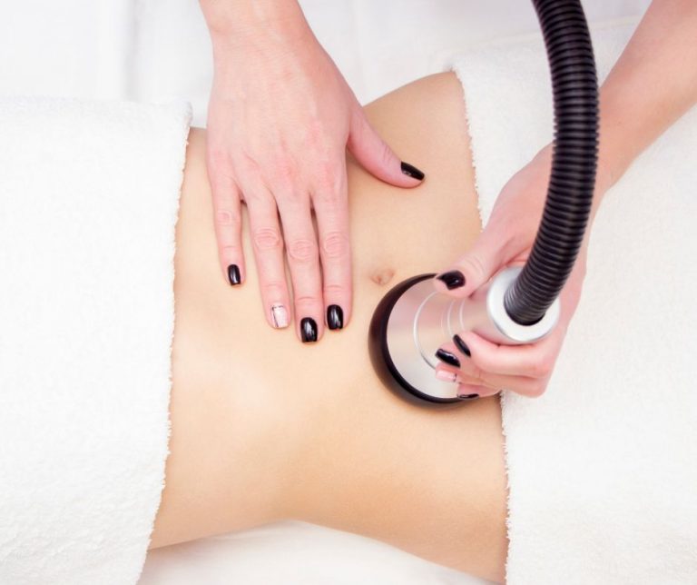Laser liposuction