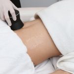 Laser-Liposuktion - wie viel Gewicht kann man nach dem Eingriff verlieren?