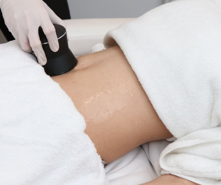 Laserfettsuging - hvor mye kan man gå ned i vekt etter inngrepet?