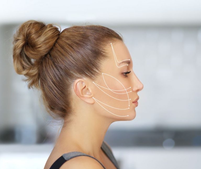 Facelift - a rejuvenating treatment