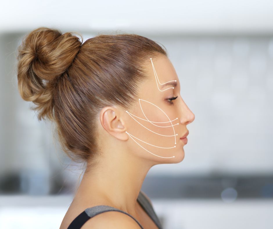 Facelift - eine Verjüngungskur