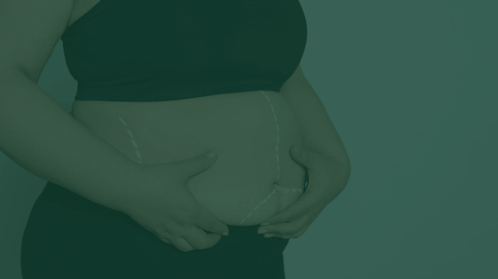 laser liposuction price