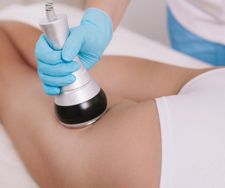 Laser liposuction - does the fat come back after this procedure?