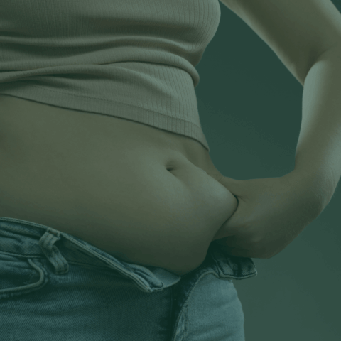 Czy po liposukcji tłuszcz wraca? Sprawdź, jak długo utrzymują się efekty