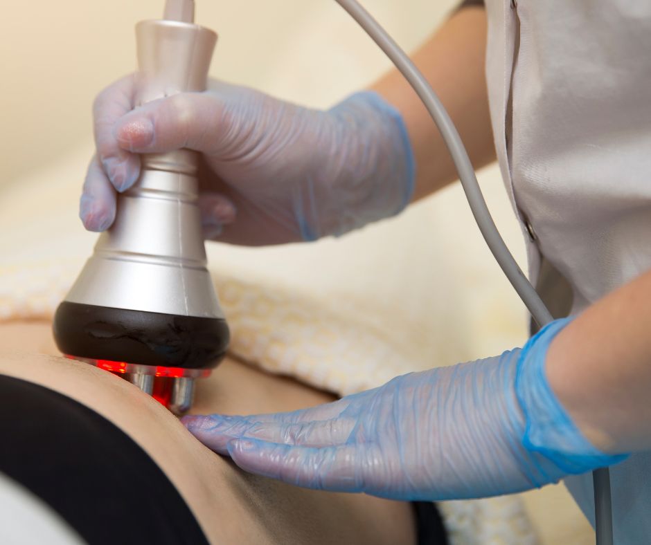 Laser-Liposuktion