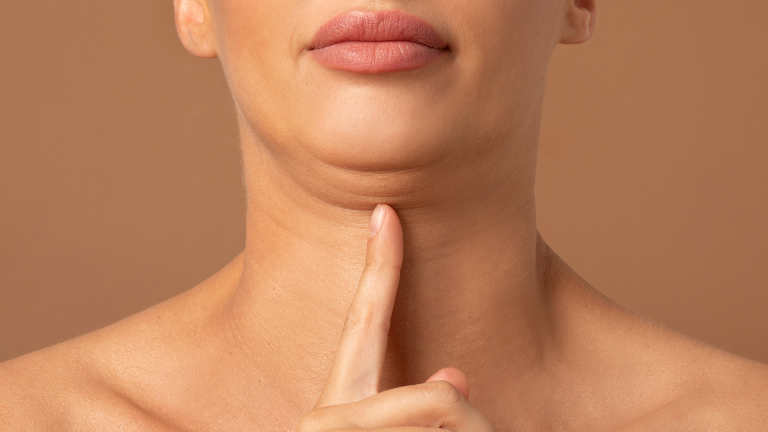 Double chin