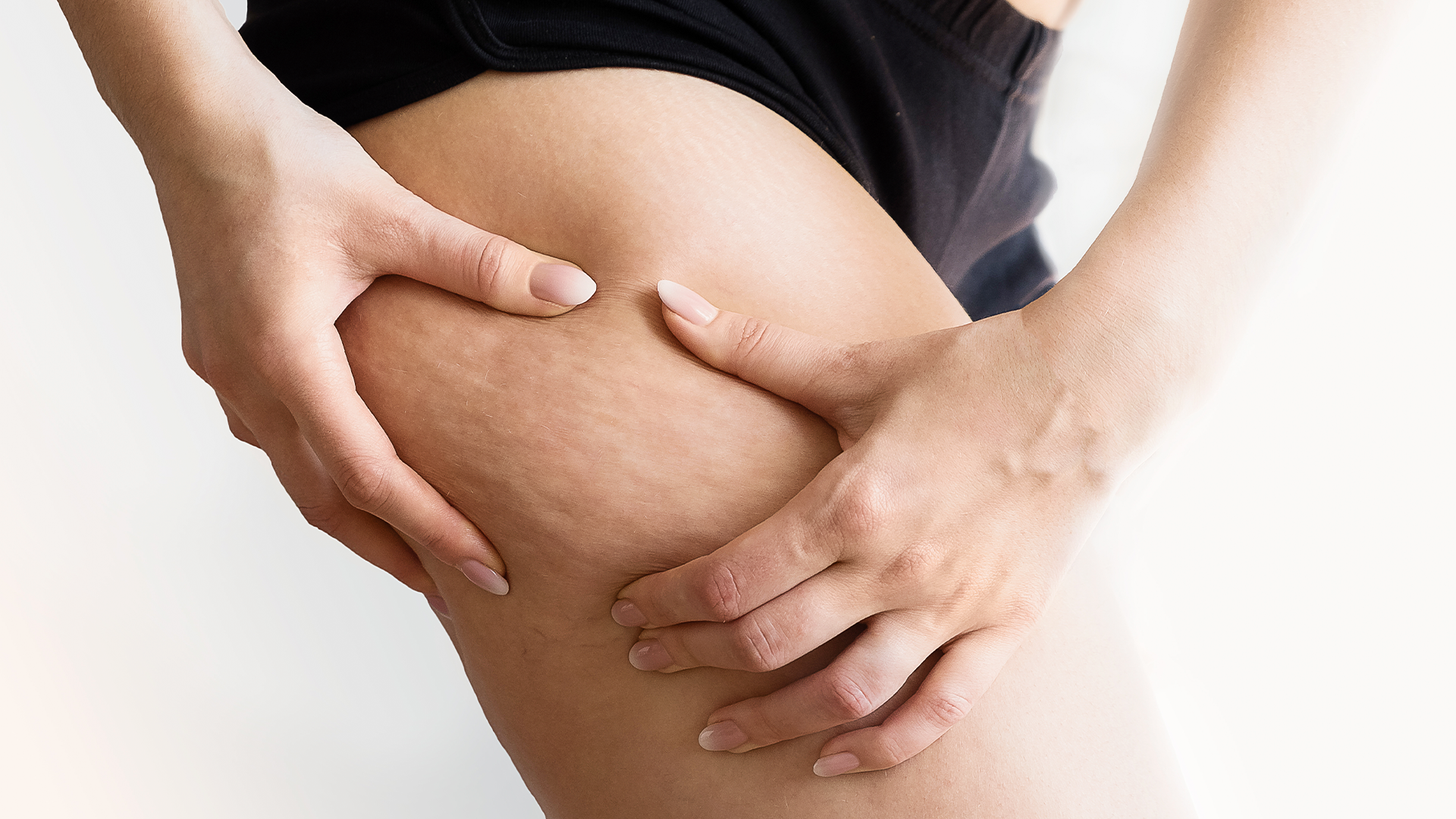 cellulite reduction