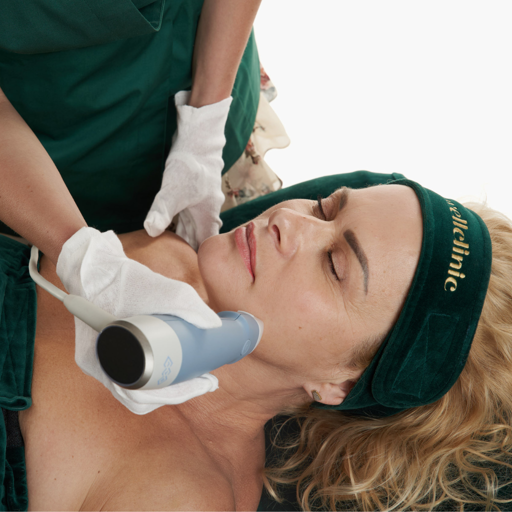 RF Exion-Behandlung