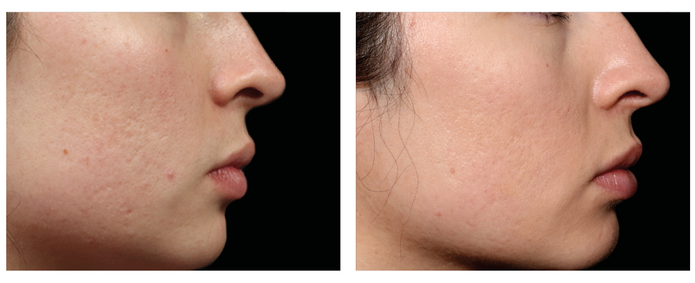 Effects of treatments