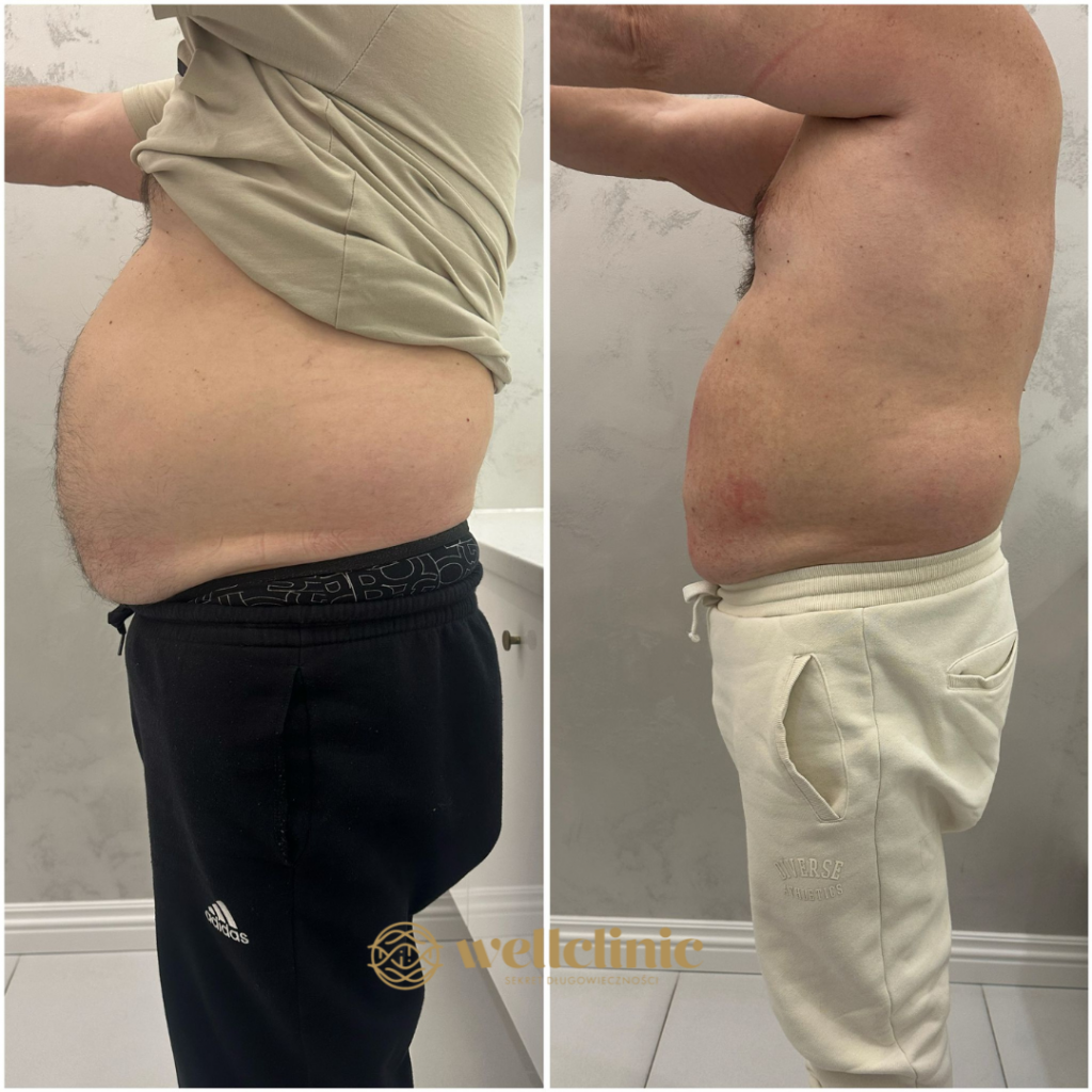 MetamorfoseVegttab