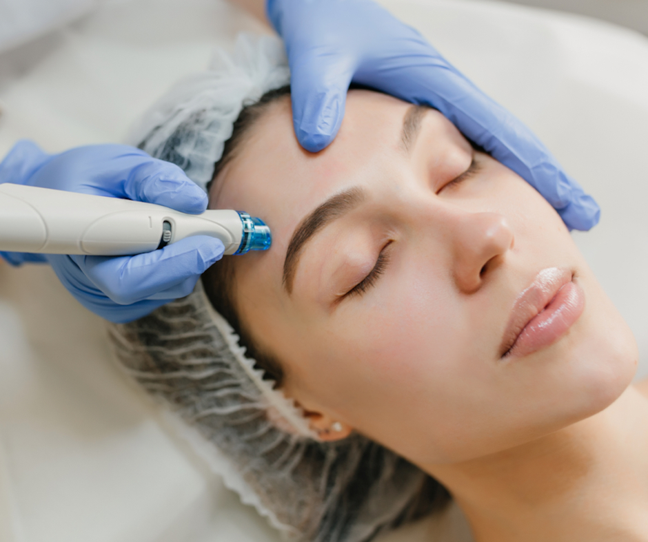 Dermapen – mikronakłuwanie skóry
