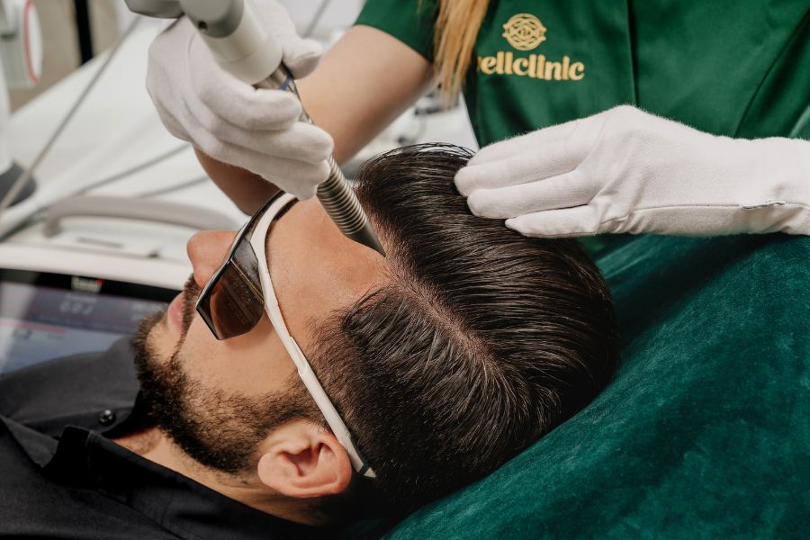 androgenetic alopecia