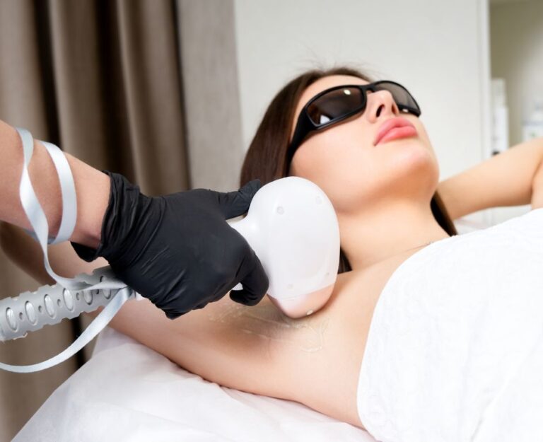 Wie man sich auf die Laser-Haarentfernung vorbereitet – alles, was Sie wissen müssen