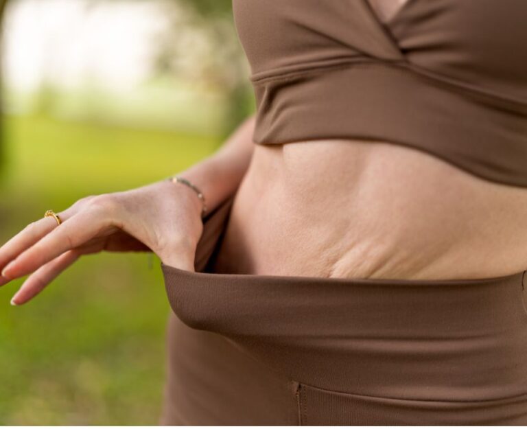 Überschüssige Haut nach dem Abnehmen