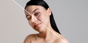 Метаморфозы