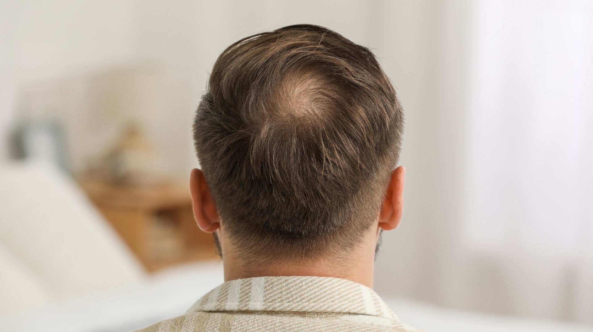 androgenetische Alopezie