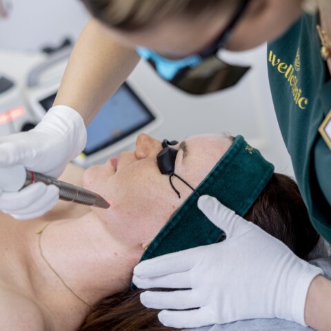 Leczenie trądziku – nowoczesna terapia aktywnych zmian skórnych i blizn potrądzikowych