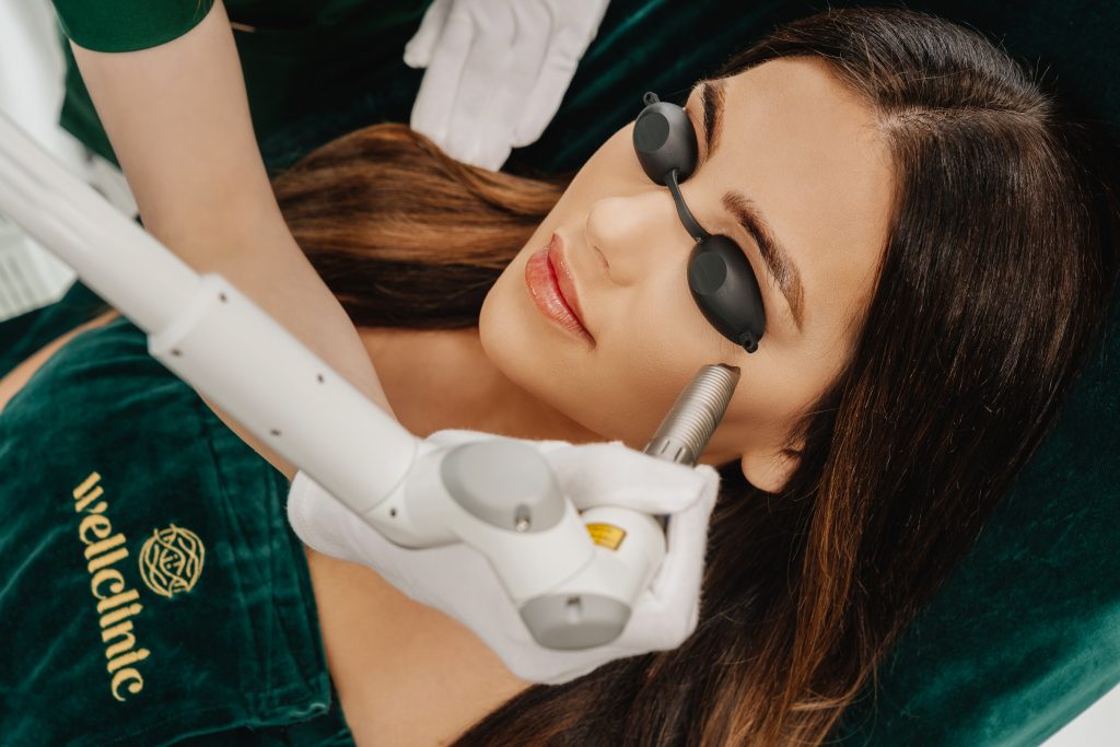 Laser-Blepharoplastik