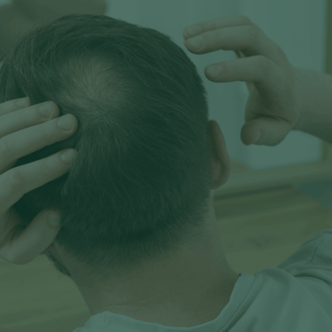 Fotona Hair Restoration – leczenie łysienia w Wellclinic