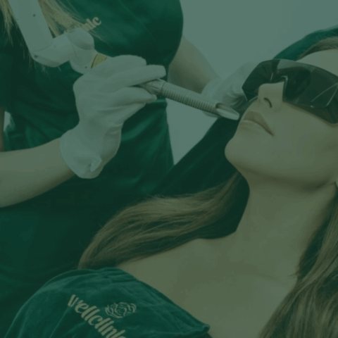 Endolifting – Ist ein Laser-Facelifting von innen eine wirksame Methode zur Hautverjüngung?