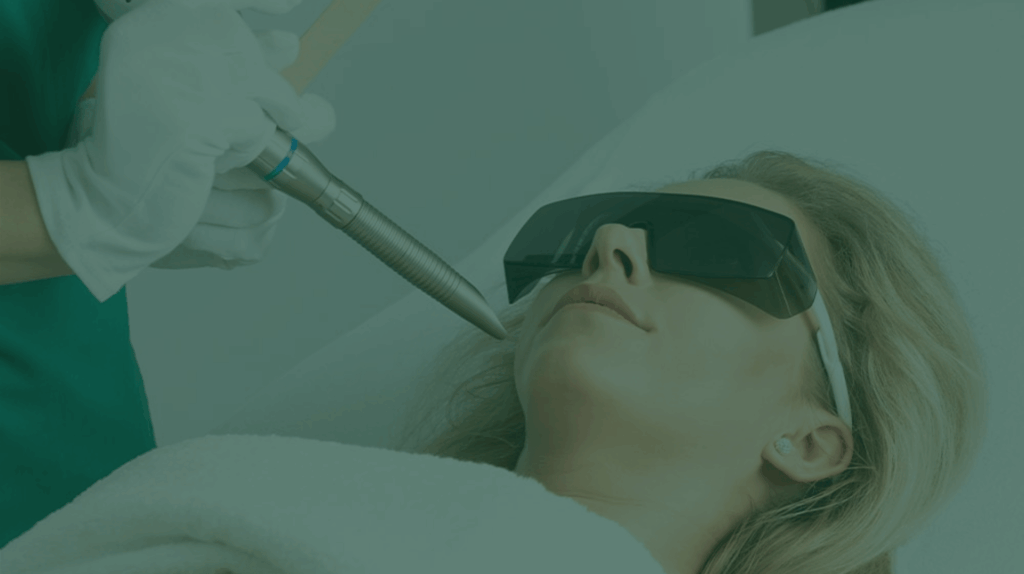Fotona 4D laser