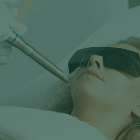 Fotona 4D – Laser-Lifting und umfassende Gesichtsverjüngung