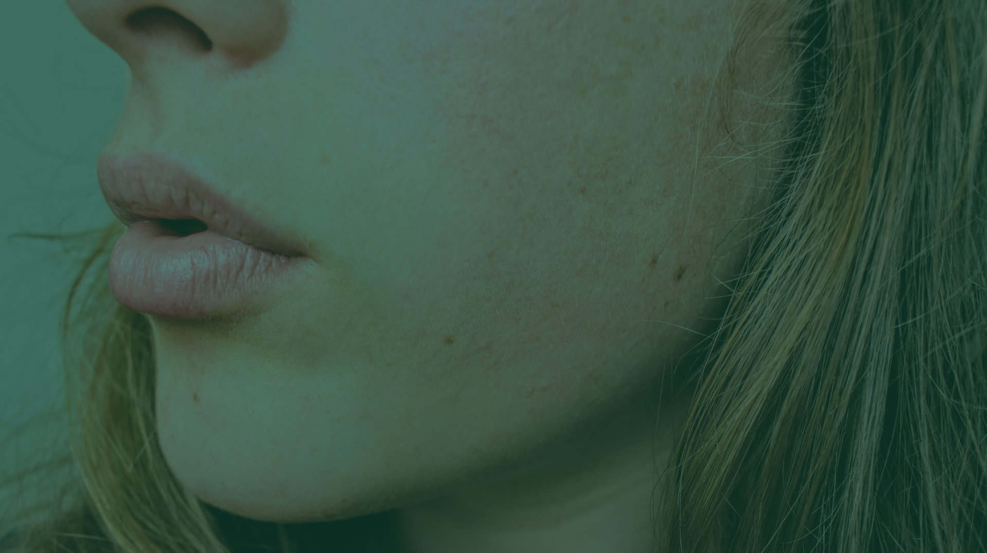 atopic dermatitis