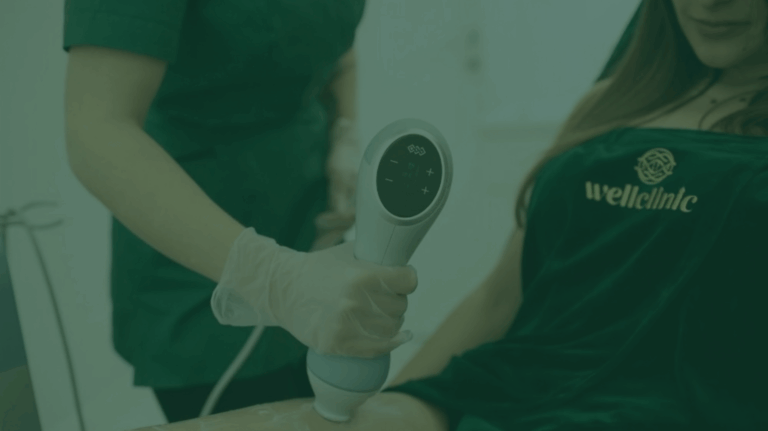 endermologia a unison