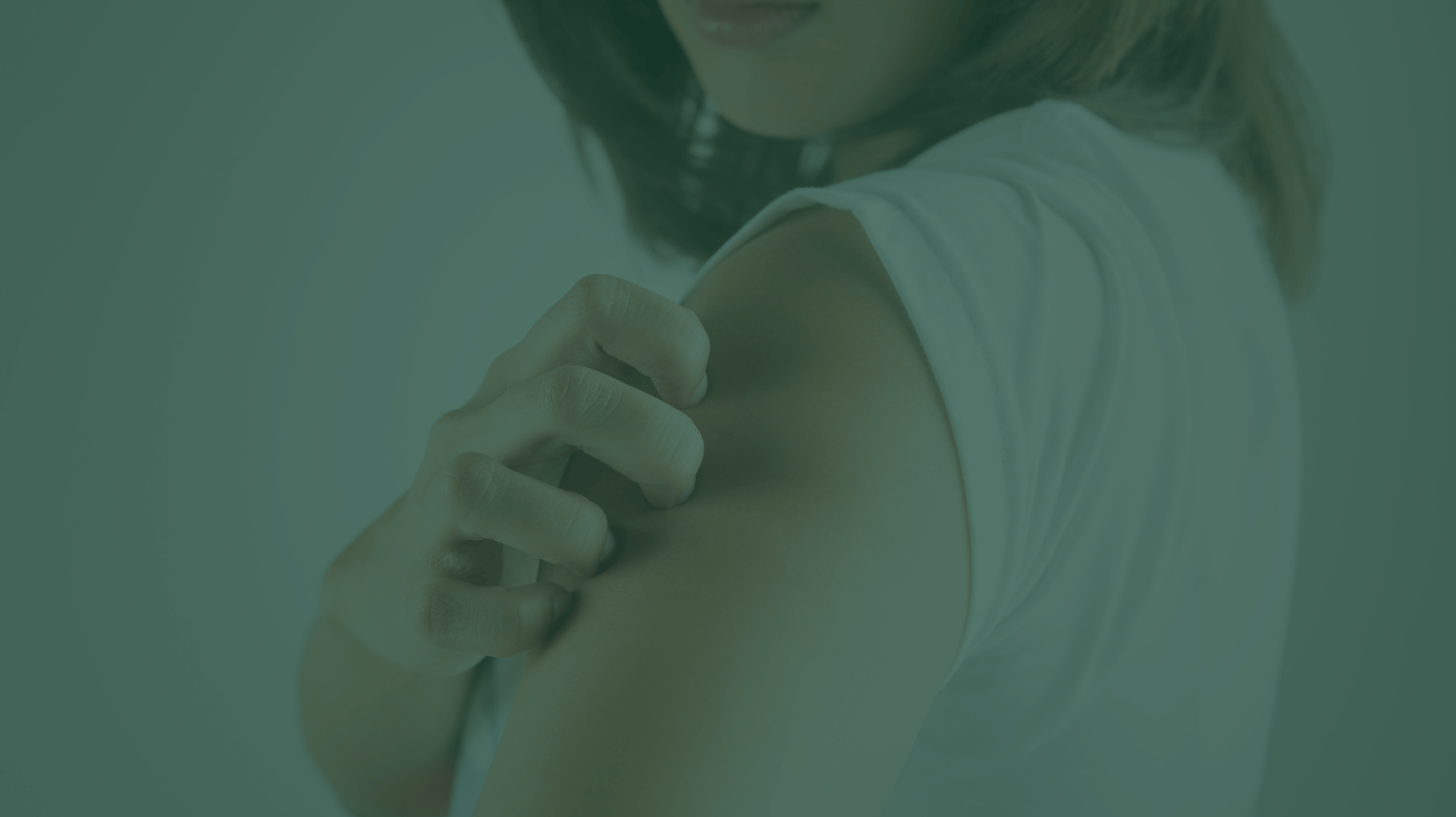 urticaria